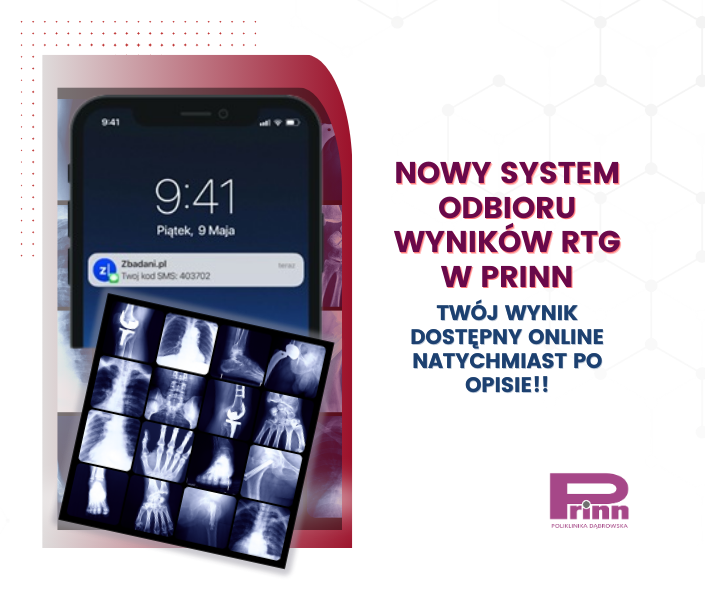 WYNIKI RTG ONLINE – NOWOŚĆ DLA PACJENTÓW!𝗨𝗪𝗔𝗚𝗔, 𝗨𝗪𝗔𝗚𝗔 𝗣𝗔𝗖𝗝𝗘𝗡𝗖𝗜!